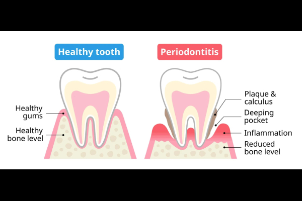 Periodontics & Gum Health